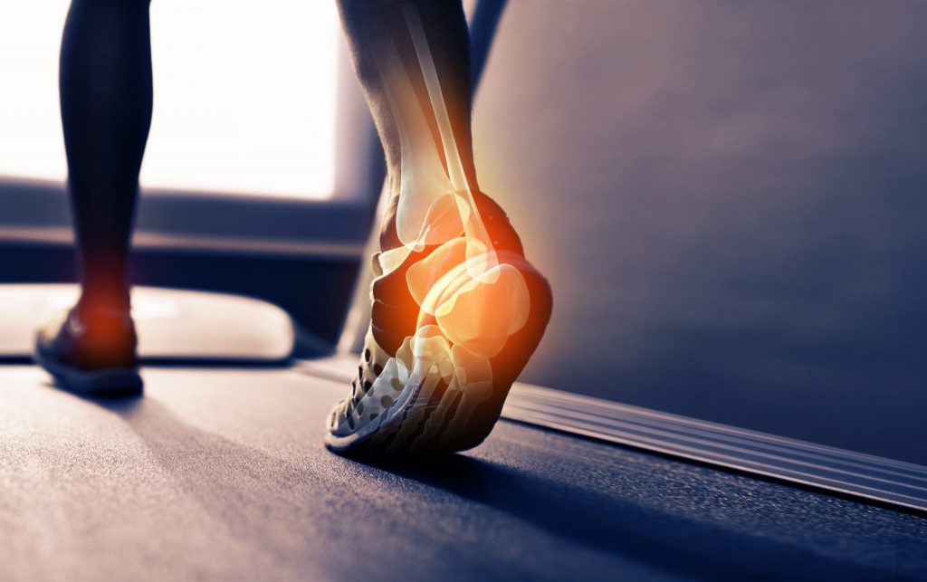 Running Orthotics Do You Need Them And Why?