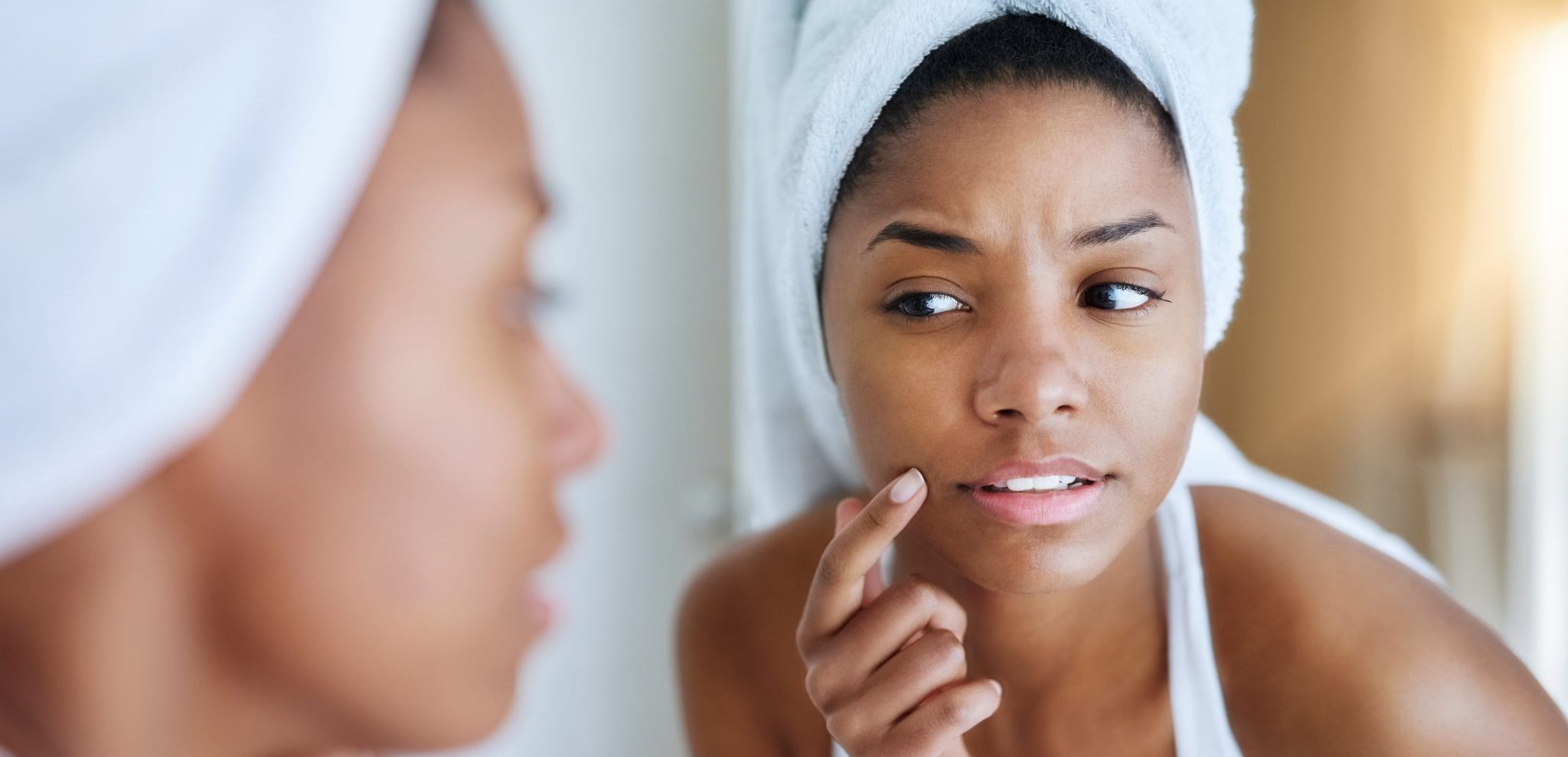 Problem Skin: Why You Have it and What to Do About it